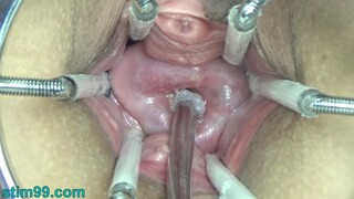 Extreme German BDSM Needles inner Pussy Cervix and