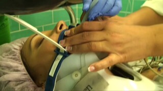 Woman Intubated