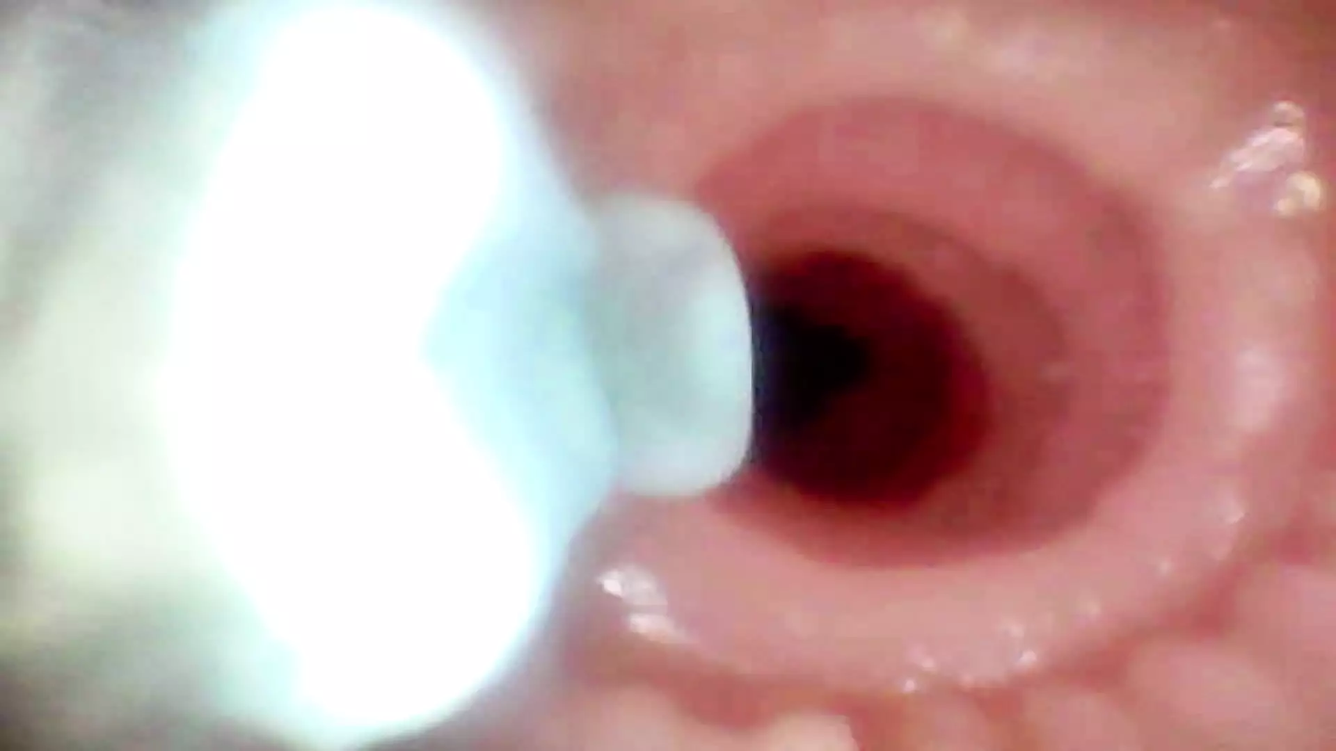 A detailed examination of Lopuza93 oral cavity and anal area using an endoscope camera.