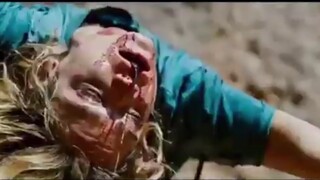 Girl falls and gets impaled but survives