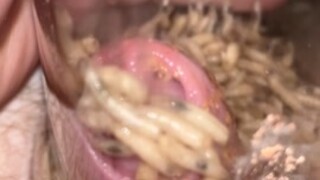 Maggots stuffing foreskin