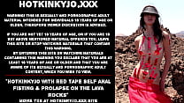 Hotkinkyjo with red tape self anal fisting & prolapse on the lava rocks