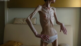 anorexic Denisa 8t00791 20-02-2023